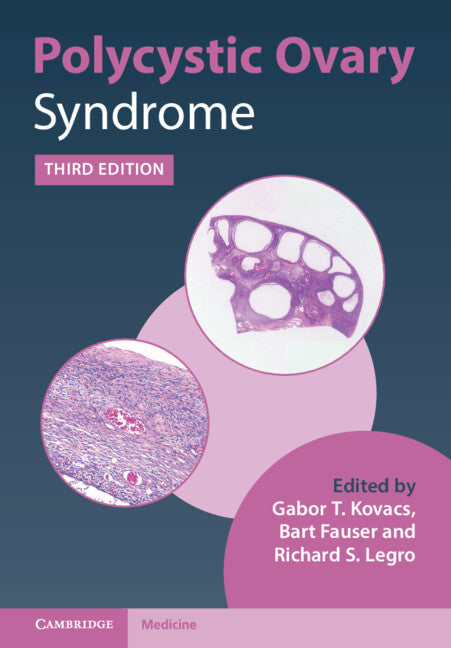 Polycystic Ovary Syndrome (Hardback) 9781108839334
