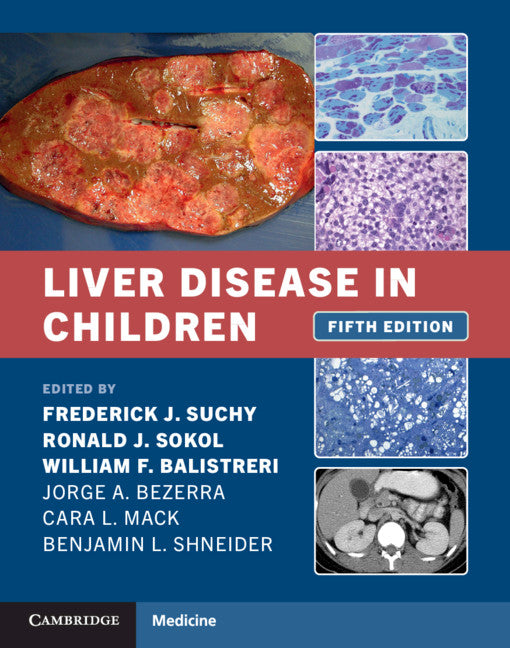 Liver Disease in Children (Hardback) 9781108843515