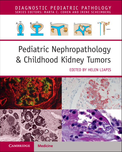 Pediatric Nephropathology & Childhood Kidney Tumors with Online Resource (Multiple-component retail product) 9781108907231