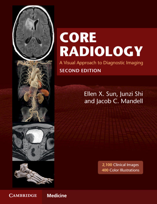 Core Radiology; A Visual Approach to Diagnostic Imaging (Multiple-component retail product) 9781108965910