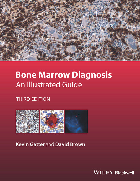 Bone Marrow Diagnosis – An Illustrated Guide 3e (Hardback) 9781118253656