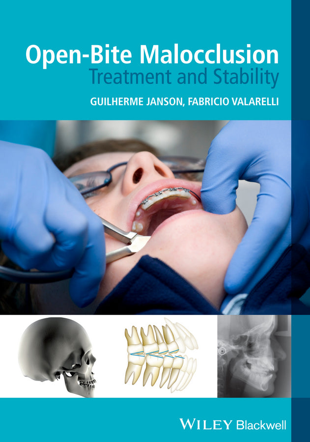 Open–Bite Malocclusion – Treatment and Stability (Paperback / softback) 9781118335987