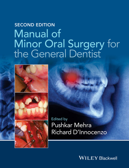 Manual of Minor Oral Surgery for the General Dentist 2e (Paperback / softback) 9781118432150