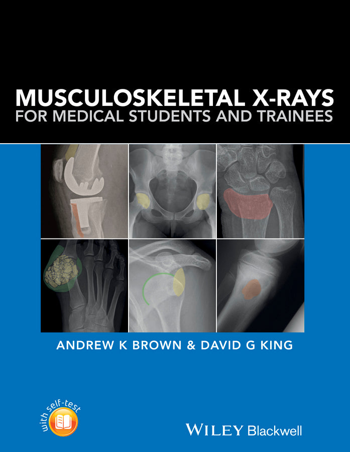 Musculoskeletal X–rays for Medical Students (Paperback / softback) 9781118458730