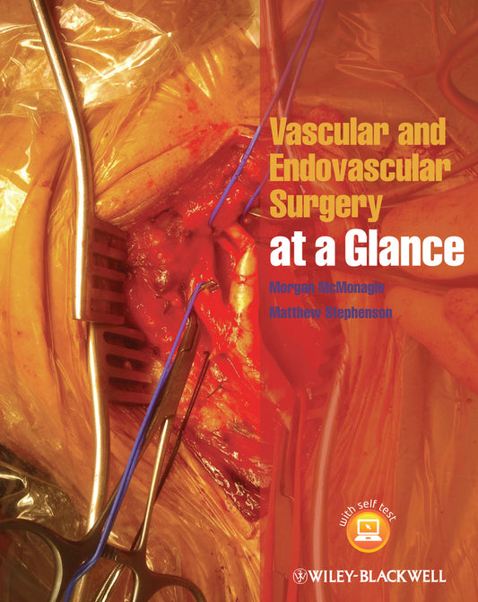 Vascular and Endovascular Surgery at a Glance (Paperback / softback) 9781118496039