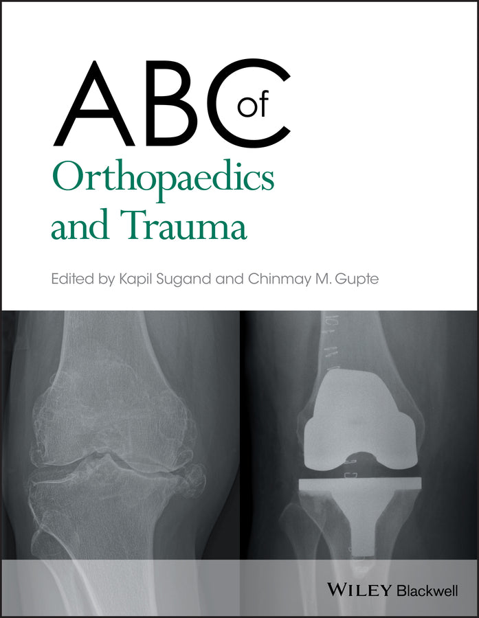 ABC of Orthopaedics and Trauma (Paperback / softback) 9781118561225