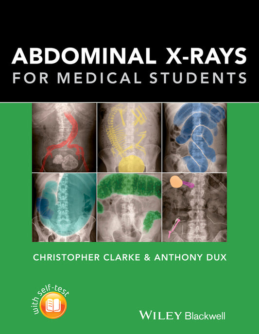 Abdominal X–rays for Medical Students (Paperback / softback) 9781118600559