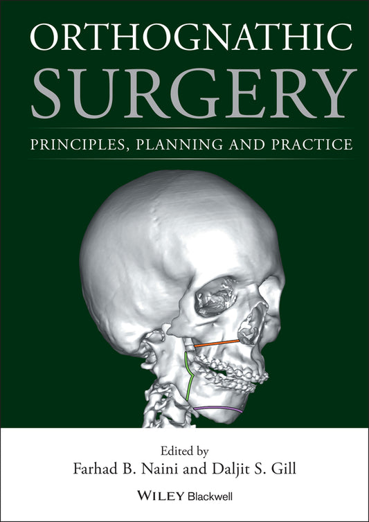 Orthognathic Surgery – Principles, Planning and Practice (Hardback) 9781118649978