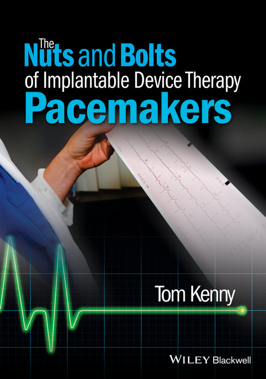 The Nuts and Bolts of Implantable Device Therapy – Pacemakers (Paperback / softback) 9781118670675