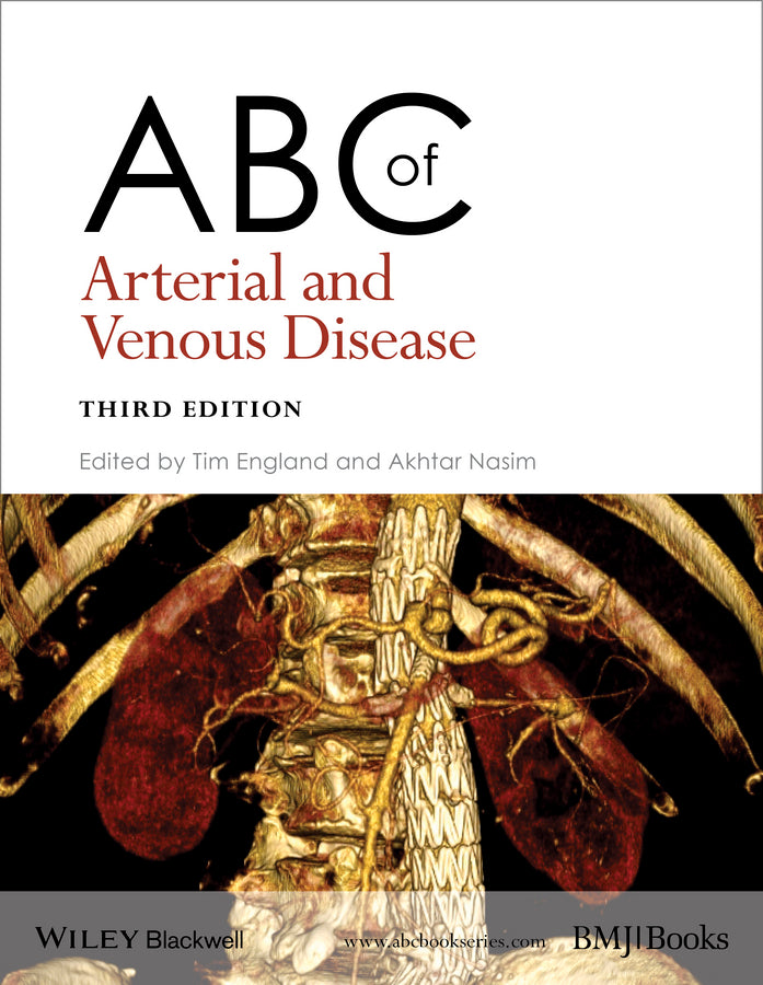 ABC of Arterial and Venous Disease 3e (Paperback / softback) 9781118740682