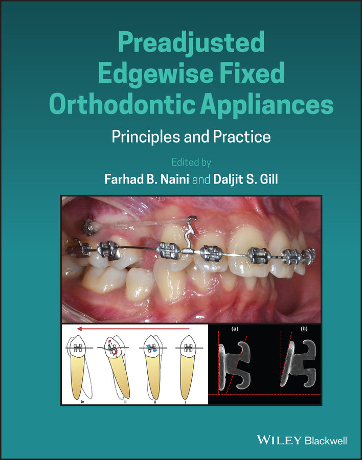 Preadjusted Edgewise Fixed Orthodontic Appliances – Principles and Practice (Hardback) 9781118817698