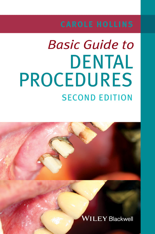 Basic Guide to Dental Procedures 2e (Paperback / softback) 9781118924556