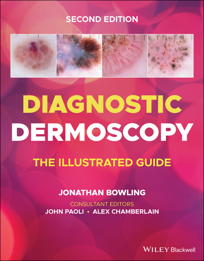 Diagnostic Dermoscopy – The Illustrated Guide, 2e (Paperback / softback) 9781118930489