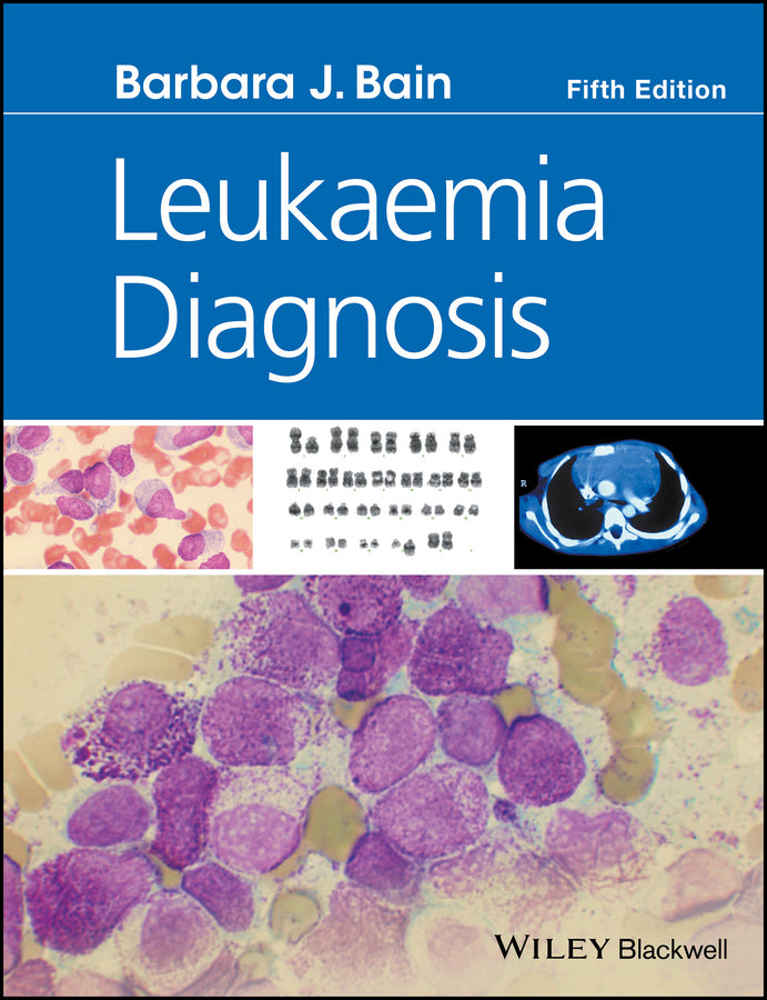 Leukaemia Diagnosis 5e (Hardback) 9781119210542