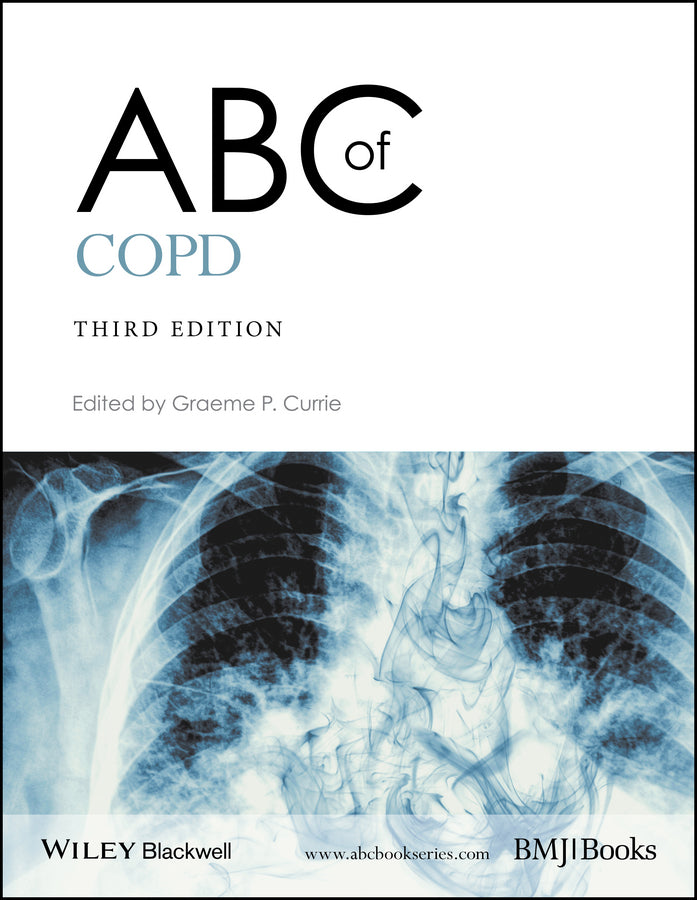 ABC of COPD, 3e (Paperback / softback) 9781119212850