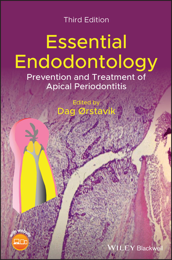 Essential Endodontology – Prevention and Treatment of Apical Periodontitis, 3rd Edition (Hardback) 9781119271956