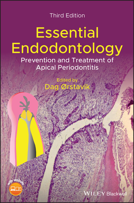 Essential Endodontology – Prevention and Treatment of Apical Periodontitis, 3rd Edition (Hardback) 9781119271956