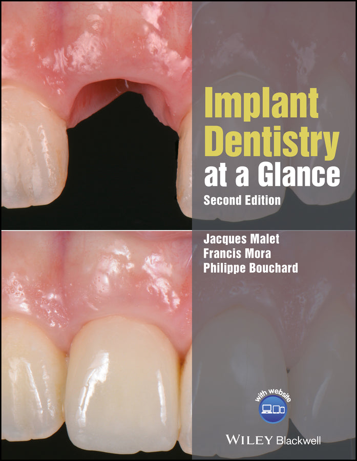 Implant Dentistry at a Glance, 2nd Edition (Paperback / softback) 9781119292609