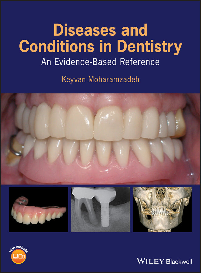 Diseases and Conditions in Dentistry – An Evidence–Based Reference (Hardback) 9781119312031