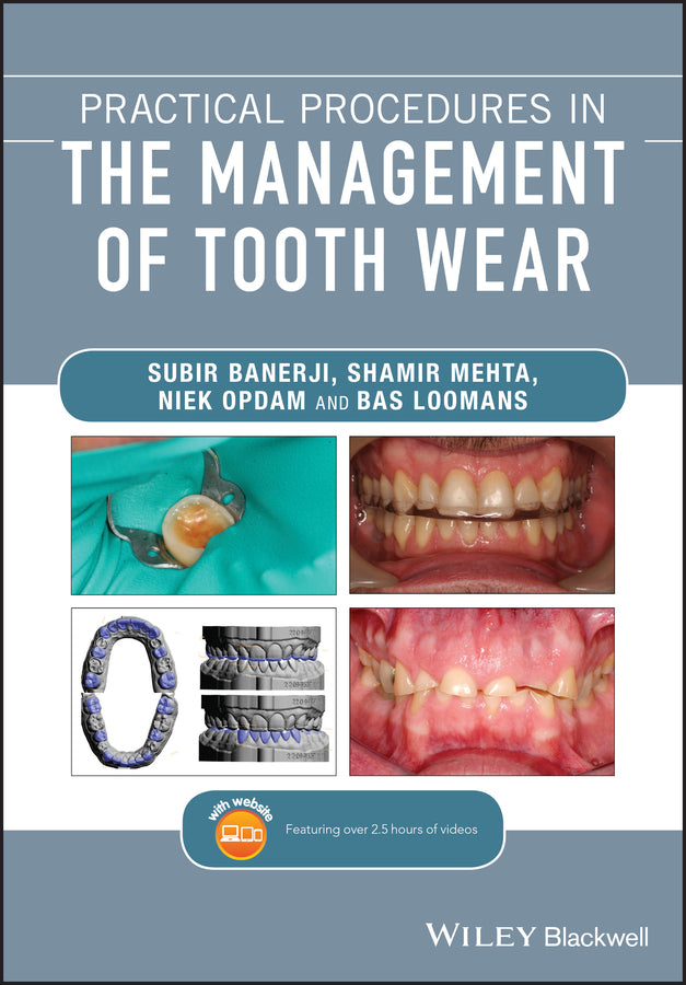 Practical Procedures in the Management of Tooth Wear (Paperback / softback) 9781119389866