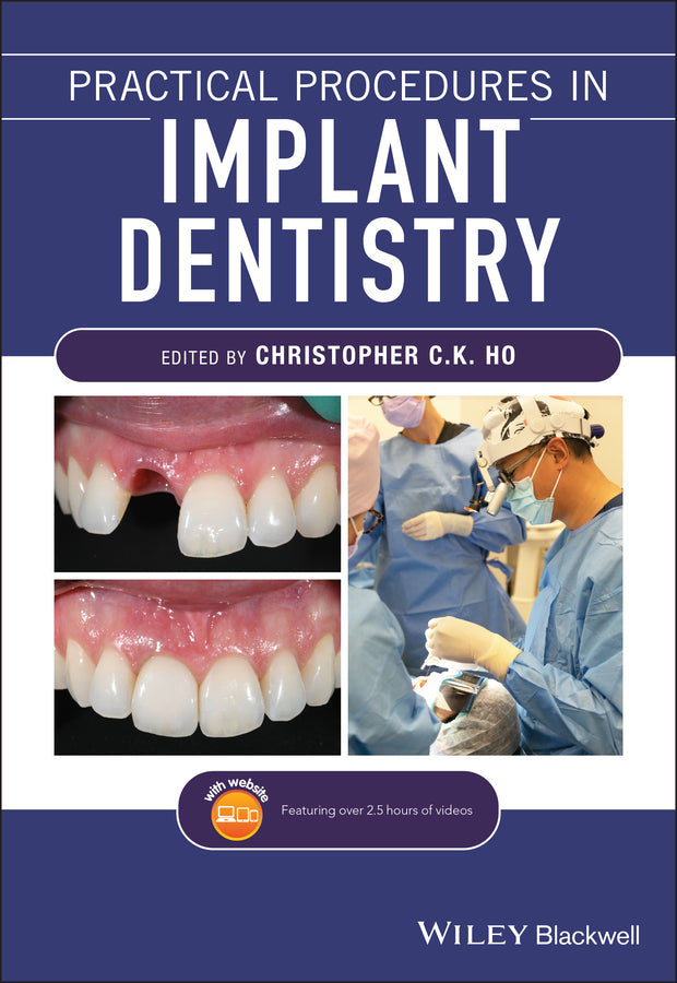 Practical Procedures in Implant Dentistry (Paperback / softback) 9781119399179