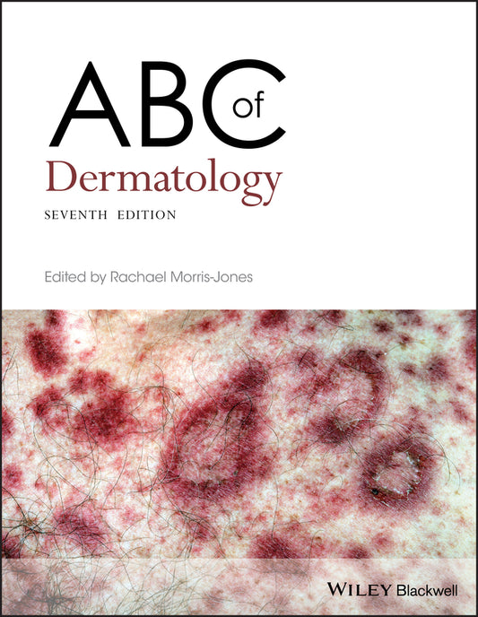 ABC of Dermatology 7th Edition (Paperback / softback) 9781119488989