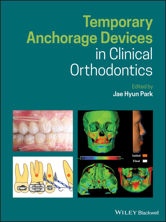 Temporary Anchorage Devices in Clinical Orthodontics (Hardback) 9781119513476