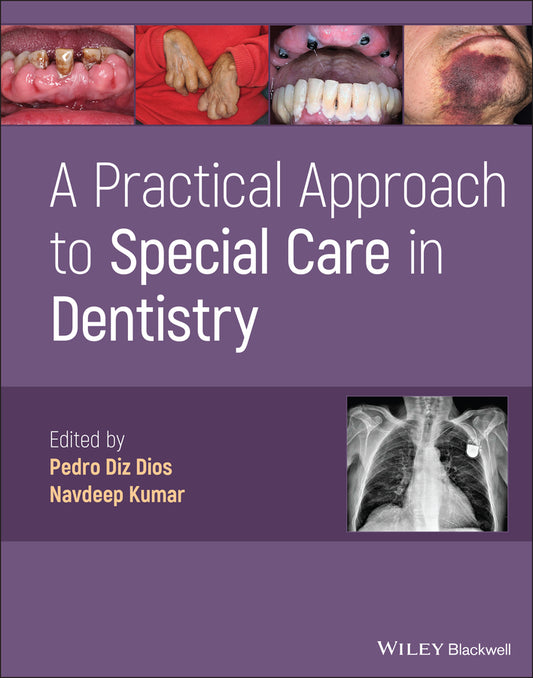 A Practical Approach to Special Care in Dentistry (Hardback) 9781119600046