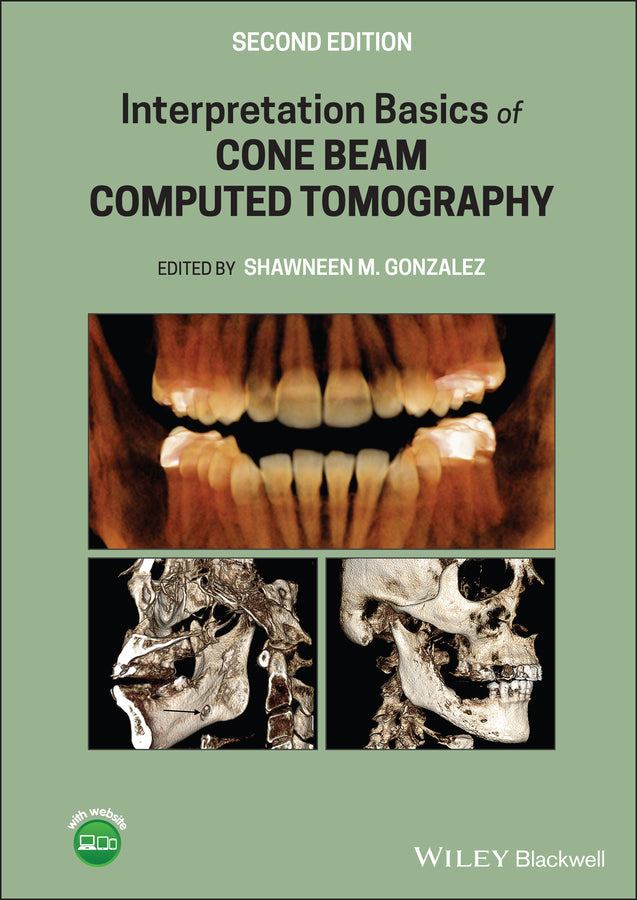 Interpretation Basics of Cone Beam Computed Tomography (Hardback) 9781119685845