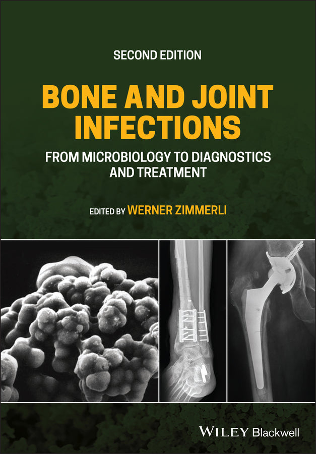 Bone and Joint Infections – From Microbiology to Diagnostics and Treatment, Second Edition (Hardback) 9781119720652