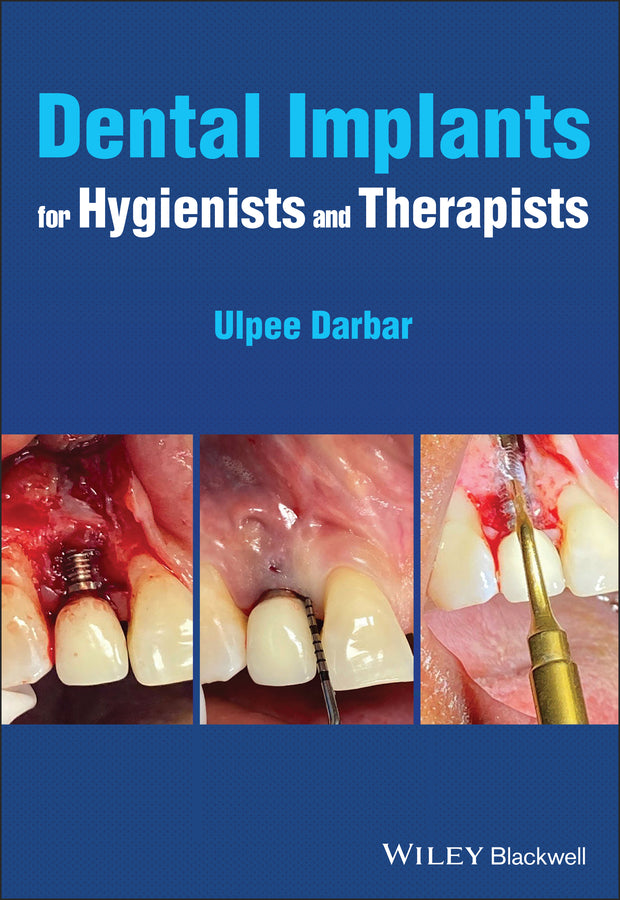 Dental Implants for Hygienists and Therapists (Paperback / softback) 9781119763826