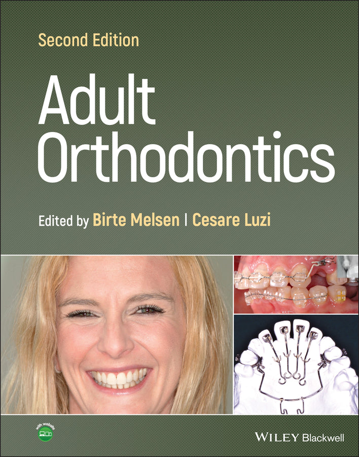 Adult Orthodontics 2nd Edition (Hardback) 9781119775775