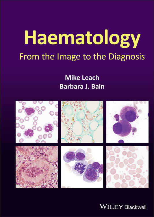 Haematology – From the Image to the Diagnosis (Hardback) 9781119777502