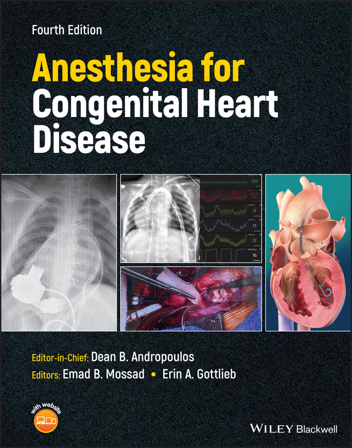 Anesthesia for Congenital Heart Disease 4e (Hardback) 9781119791652