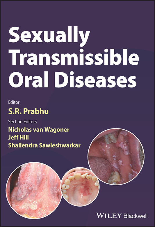 Sexually Transmissible Oral Diseases (Paperback / softback) 9781119826750