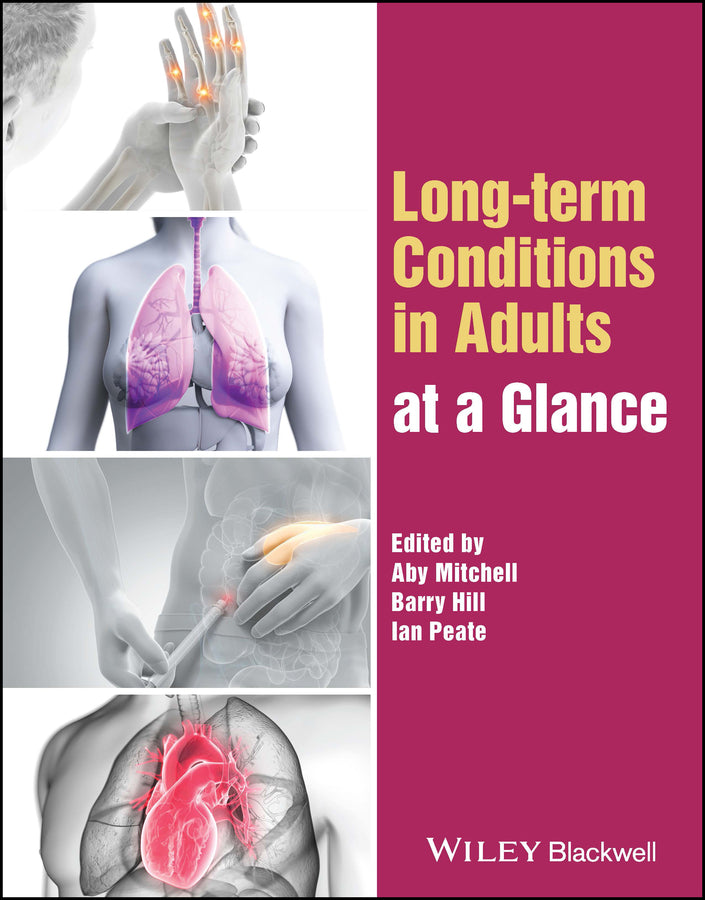 Long–term Conditions in Adults at a Glance (Paperback / softback) 9781119875871