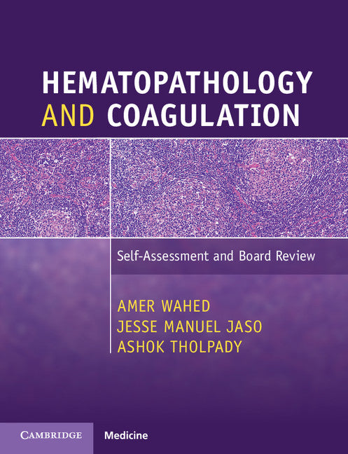 Hematopathology and Coagulation; Self-Assessment and Board Review (Paperback / softback) 9781316505601