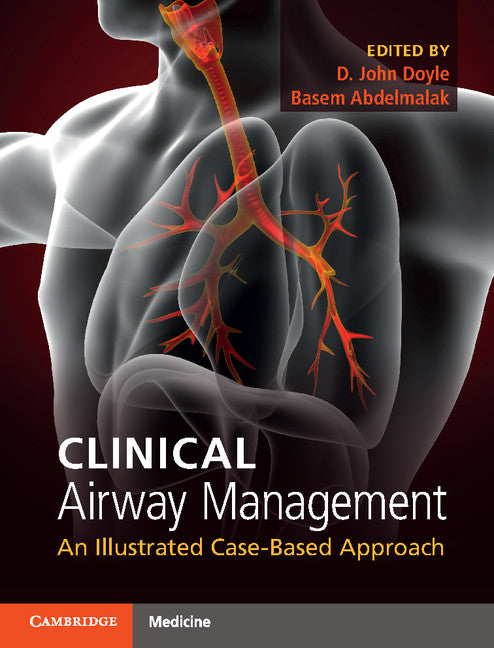 Clinical Airway Management; An Illustrated Case-Based Approach (Multiple-component retail product) 9781316601358