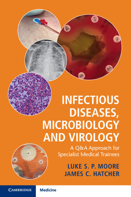 Infectious Diseases, Microbiology and Virology; A Q&A Approach for Specialist Medical Trainees (Paperback / softback) 9781316609712