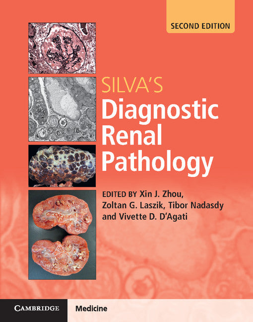 Silva's Diagnostic Renal Pathology (Multiple-component retail product) 9781316613986