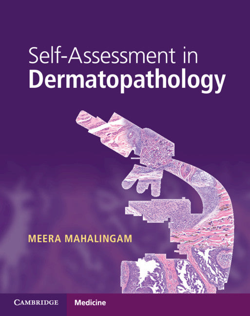 Self-Assessment in Dermatopathology (Paperback / softback) 9781316622872