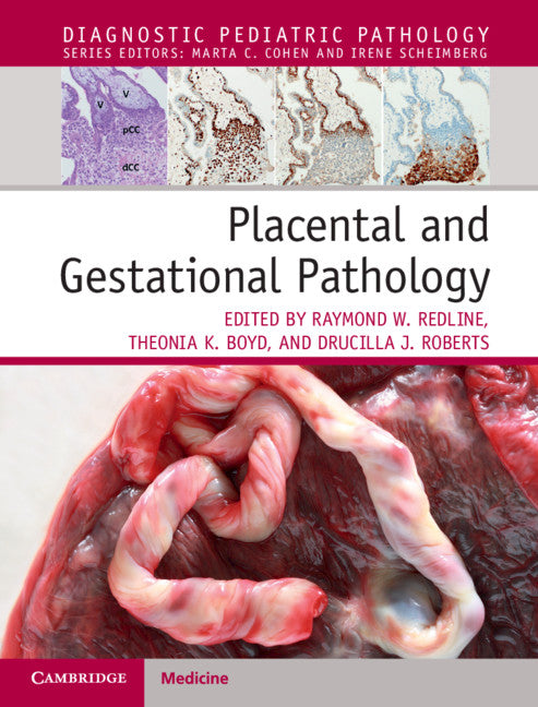 Placental and Gestational Pathology Hardback with Online Resource (Multiple-component retail product) 9781316632536