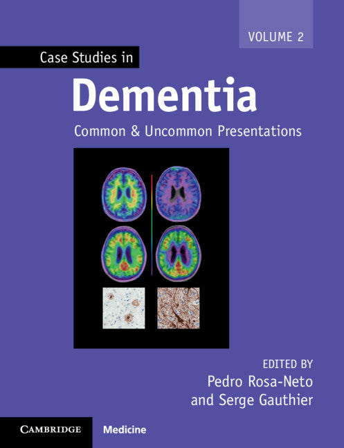 Case Studies in Dementia; Common and Uncommon Presentations (Paperback / softback) 9781316638057