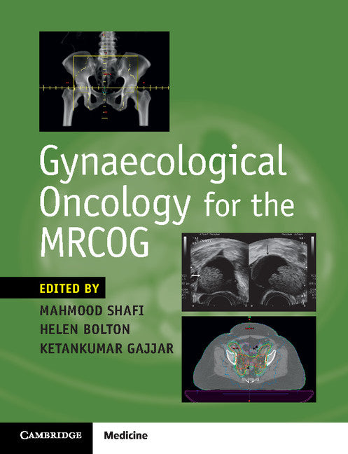 Gynaecological Oncology for the MRCOG (Paperback / softback) 9781316638712