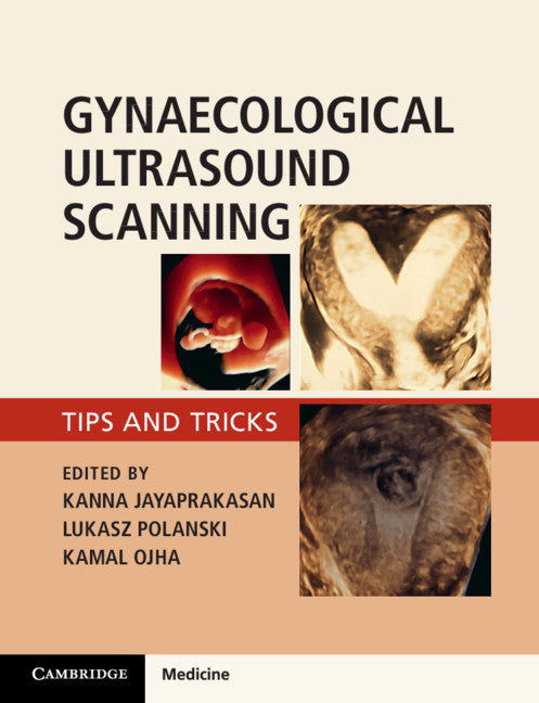 Gynaecological Ultrasound Scanning; Tips and Tricks (Paperback / softback) 9781316645178