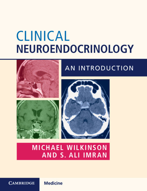 Clinical Neuroendocrinology; An Introduction (Paperback / softback) 9781316645192