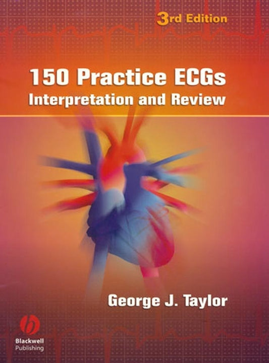 150 Practice ECGs – Interpretation and Review 3e (Paperback / softback) 9781405104838