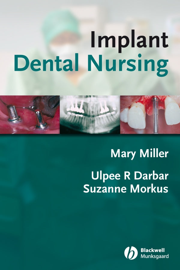 Implant Dental Nursing (Paperback / softback) 9781405144285