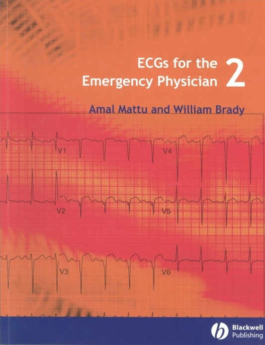 ECGs for the Emergency Physician 2e (Paperback / softback) 9781405157018