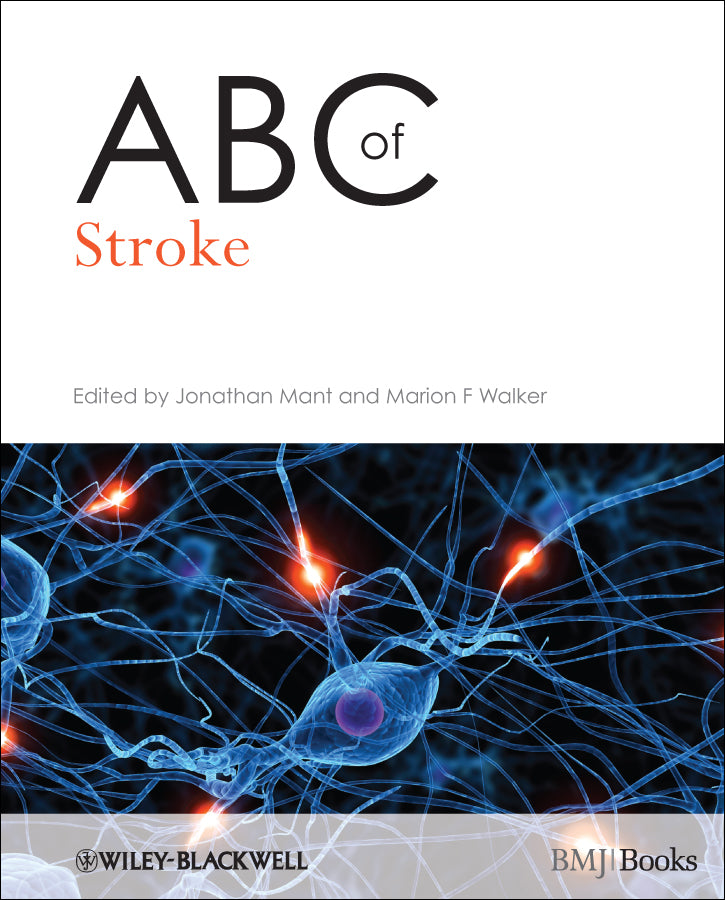 ABC of Stroke (Paperback / softback) 9781405167901